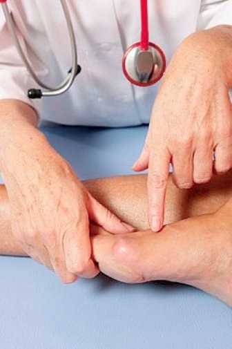 Как избавиться от шишек на больших пальцах ног