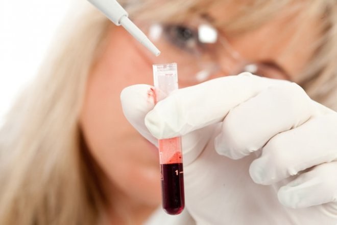 Название анализа крови на группу крови thumbnail
