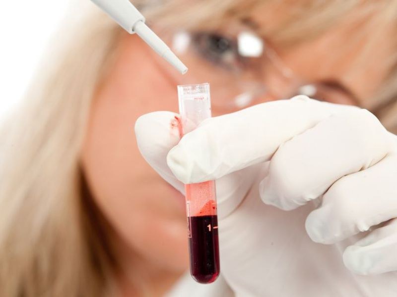 Что можно узнать по общему анализу крови и мочи thumbnail