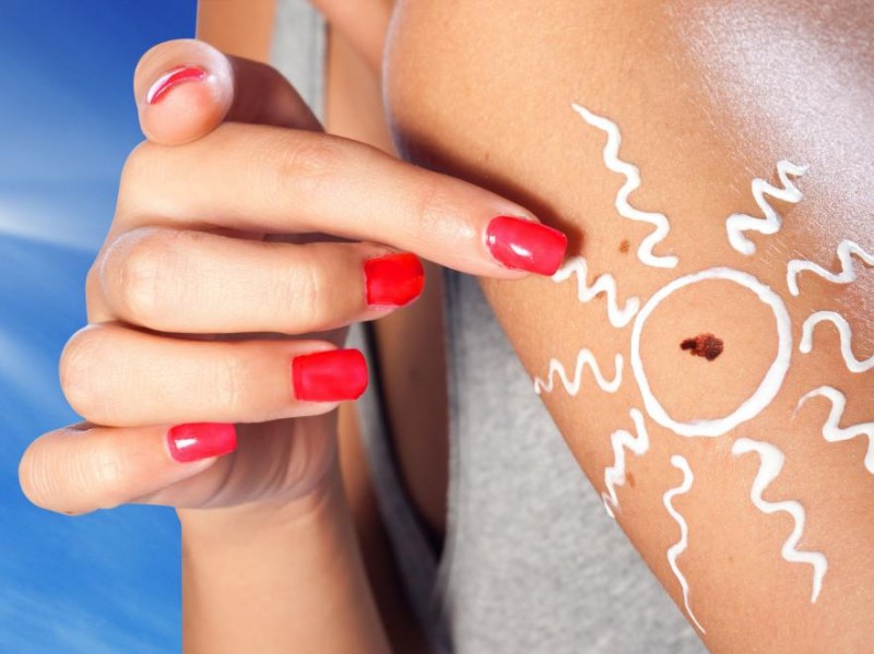 How To Recognize Skin Cancer White Spot Around Mole Disease
