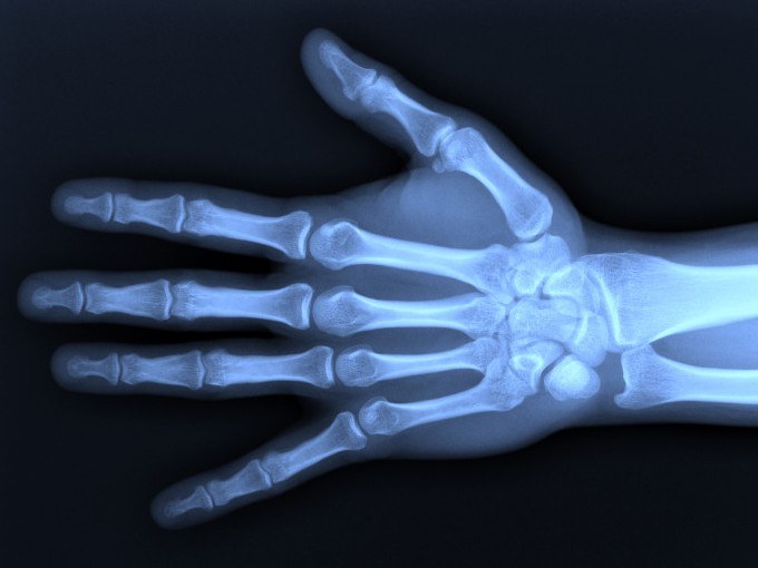 Harmful X rays How X rays Affect The Body More