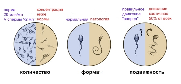 спермограмма