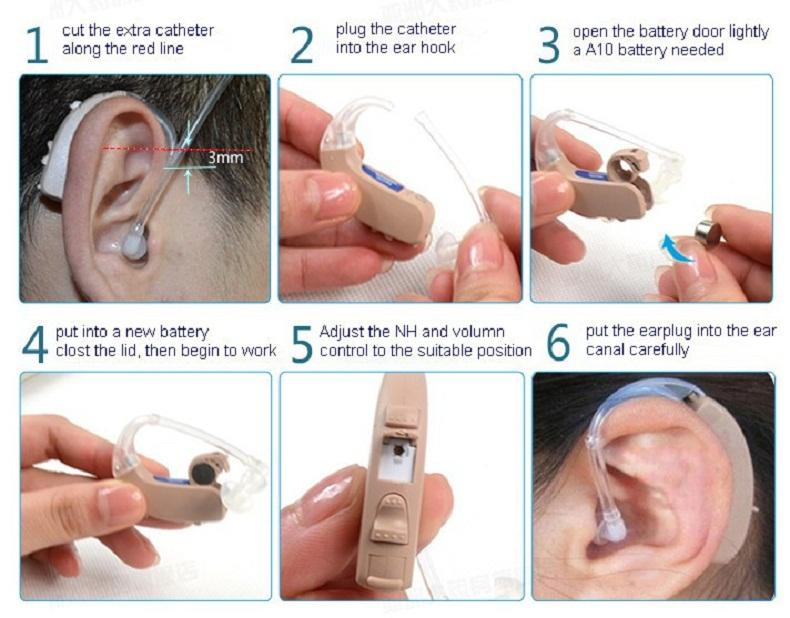 Сименс, слуховые аппараты: характеристики и инструкция