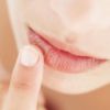 Как предотвратить появление трещин на губах