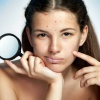 Что поможет добиться чистой кожи без угревой сыпи?  