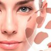 Гиперпигментация кожи: причины и лечение в домашних условиях