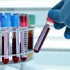 РМП анализ крови: что это такое, расшифровка, как сдавать