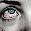 Как избавиться от воспаления глаз