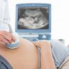 Доплер УЗИ при беременности: что это такое, описание 