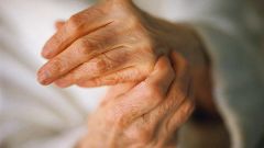 Как лечить артрит рук