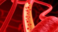 How to strengthen weak blood vessels