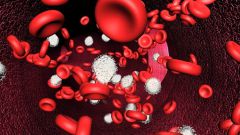 How to increase hemoglobin-old child