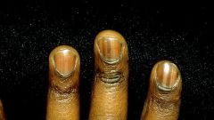 Почему чернеют ногти