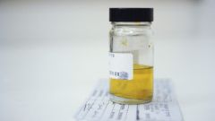 How to collect urine for analysis of sterility