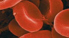 Как уменьшить гемоглобин