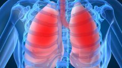 How to get rid of phlegm in the lungs