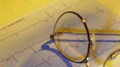 Как разобраться в результатах кардиограммы сердца