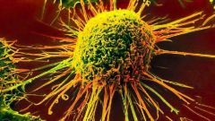 What is a cancer cell 