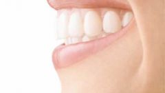 How to align a tooth without braces