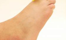 How to remove corns on feet