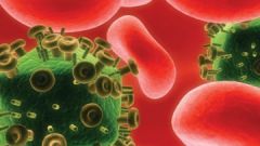Как распознать СПИД