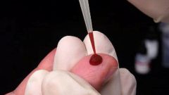 Как расшифровать общий анализ крови