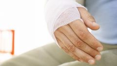 How to treat a sprain hand