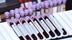 How to pass the clinical analysis of blood