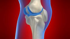 Как лечить мениск колена