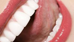 How to treat sores on the tongue