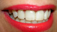 Как отбелить эмаль зубов