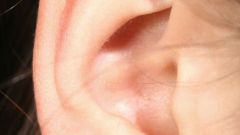 Как избавиться от черных точек в ушах