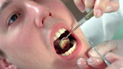 Как вылечить кисту зуба