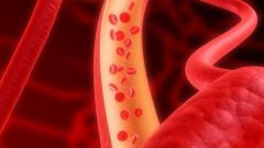 How to diagnose atherosclerosis