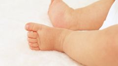 How to treat heat rash in children