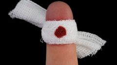 How to quickly heal a cut on your finger