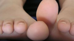 Как лечить сустав на ноге большого пальца