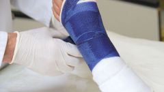 How to remove swelling after a fracture