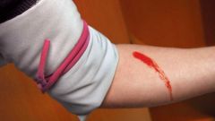 Как остановить кровотечение  при ранении