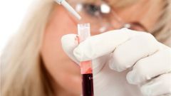 How to determine RH factor, blood group