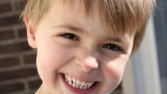 Как отбелить зубы у ребенка