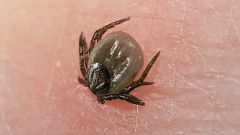 How to remove a tick from a person