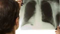 Как не заразиться туберкулезом