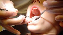 Какие зубы меняются у детей