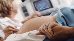 What is the probability of error in determining sex of the baby by ultrasound