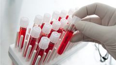 Where in Kharkov can be tested for HIV