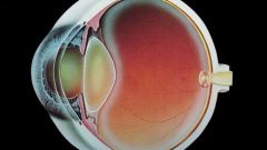 Можно ли вылечить катаракту без операции