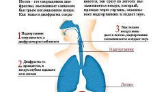 Как избавиться от икоты