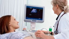 What is an ultrasound expert