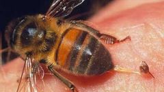 Что будет, если не вытащить жало пчелы